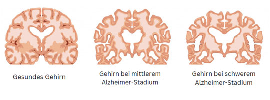 Einfach-nur-vergesslich-5