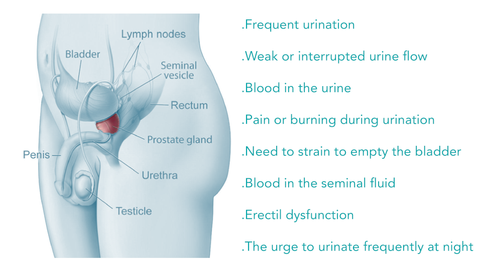 Prostate Cancer