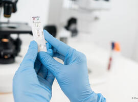 Over-the-shoulder view of a scientist evaluating a lateral flow assay kit for hantavirus diagnosis, with laboratory equipment in soft focus.