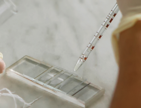Multi-Cancer Early Detection