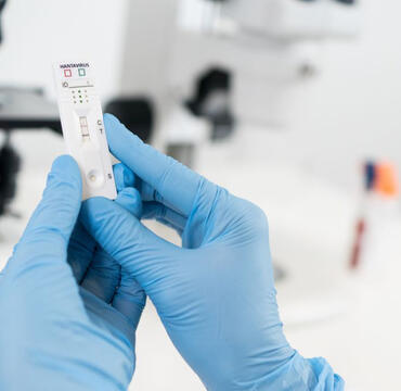 Over-the-shoulder view of a scientist evaluating a lateral flow assay kit for hantavirus diagnosis, with laboratory equipment in soft focus.