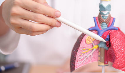 Photo Cystic Fibrosis